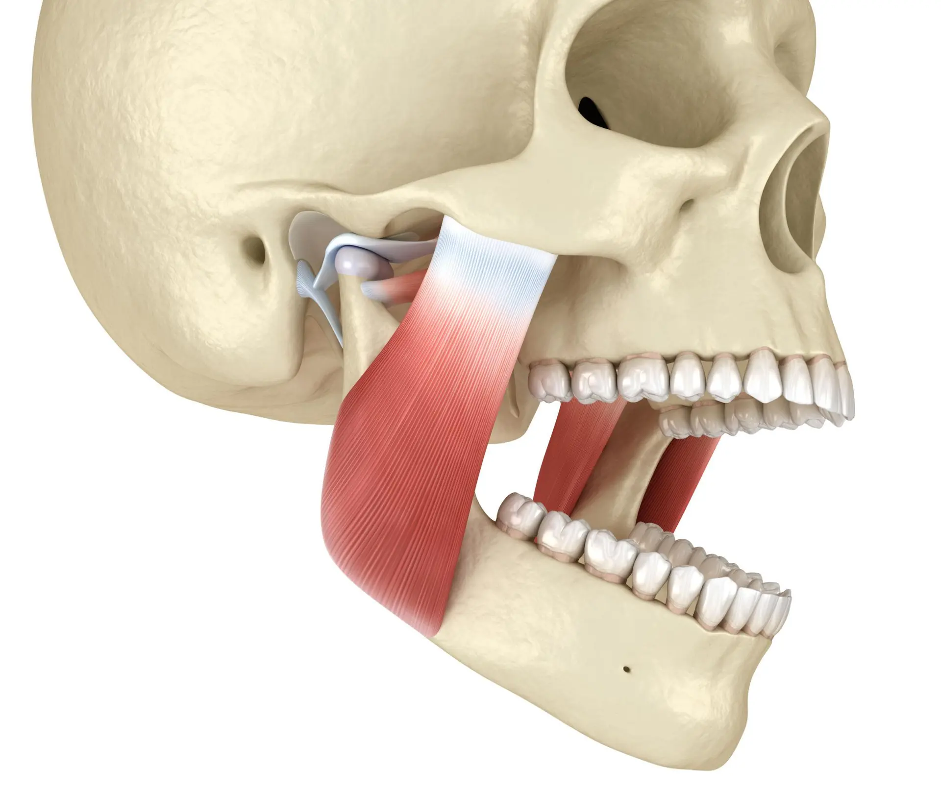 Cómo afecta el bruxismo a los músculos de la mandíbula y el cuello